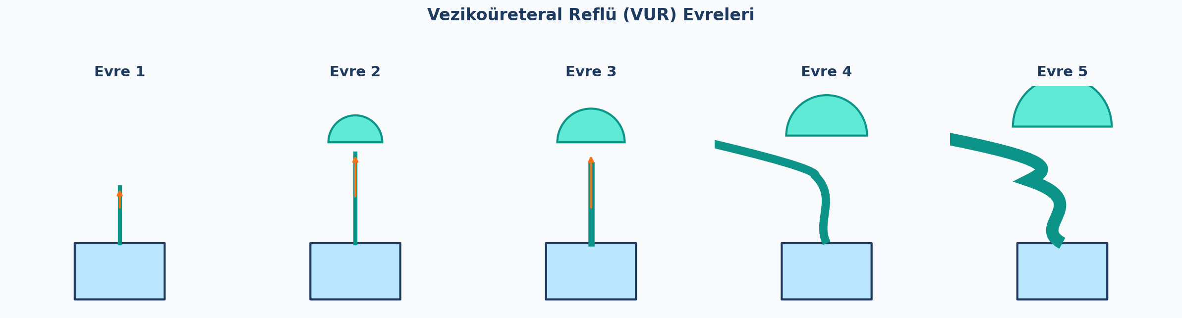 VUR Evreleri Şeması